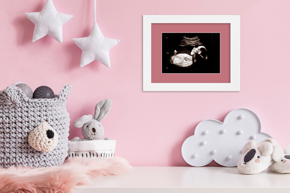 Rosa Wand mit Ultraschalbild als Baby Erinnerung